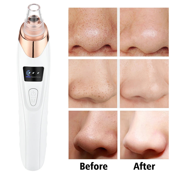 Multifunctional Beauty Pore Vacuum 4 in 1