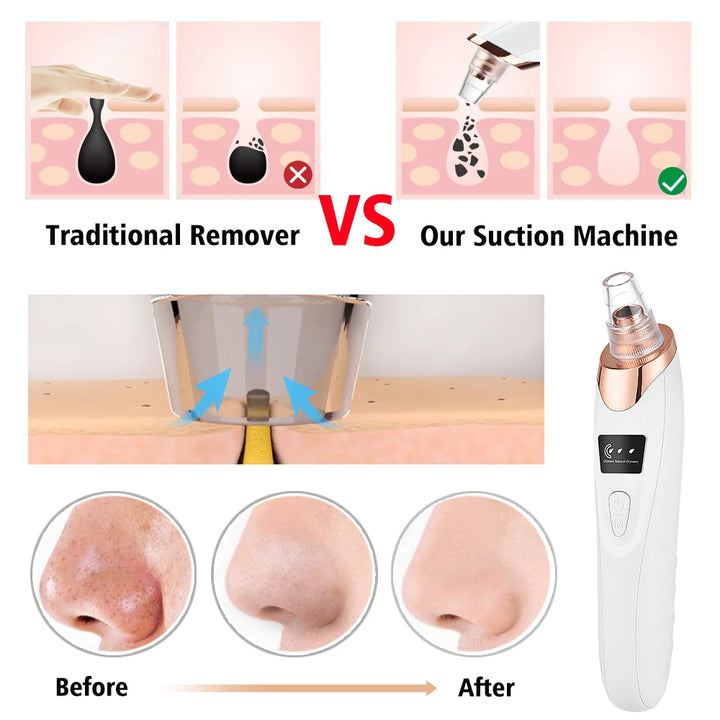 Multifunctional Beauty Pore Vacuum 4 in 1